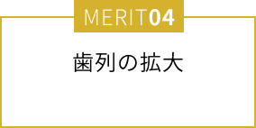 歯列の拡大