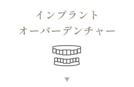 インプラントオーバーデンチャー