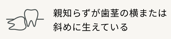 親知らずが歯茎の横または斜めに生えている