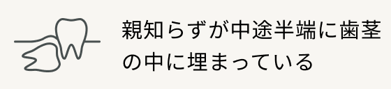 親知らずが中途半端に歯茎の中に埋まっている