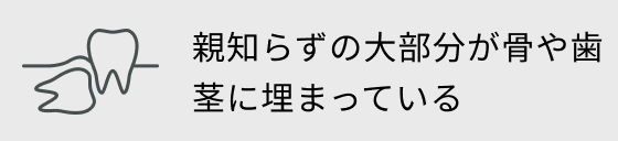 親知らずの大部分が骨や歯茎に埋まっている